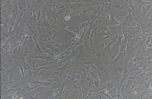 人胚胎眼巩膜成纤维细胞系;HFSF(STR鉴定正确)