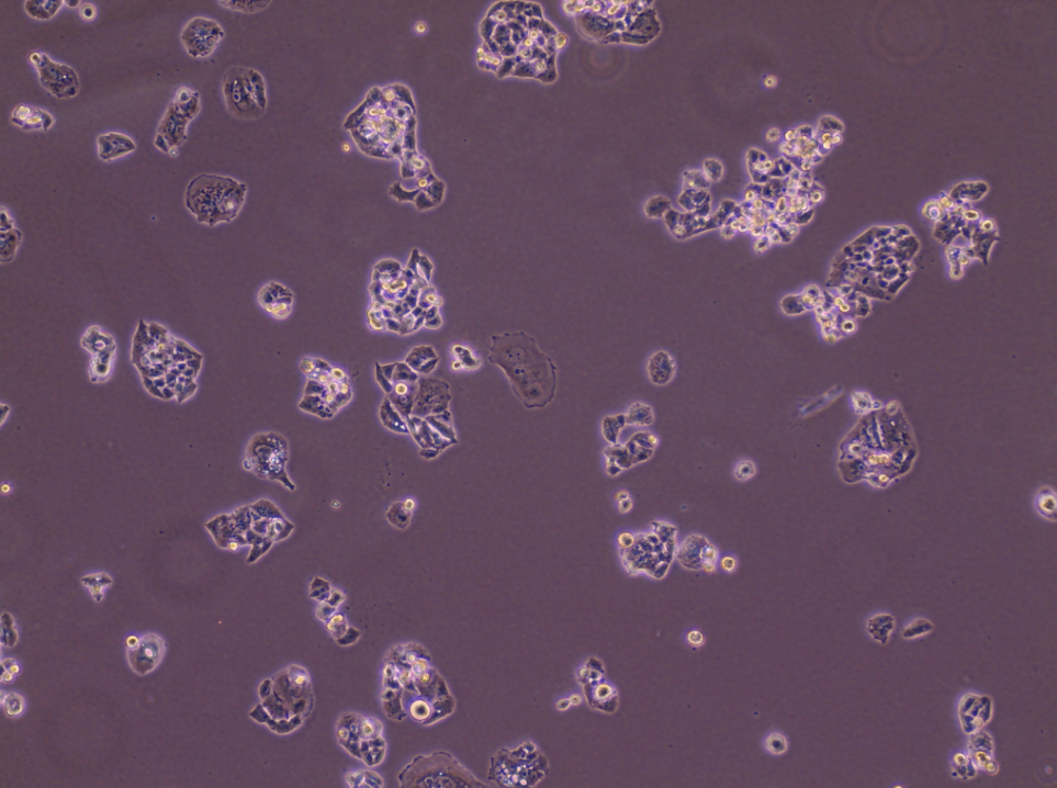 人肺腺鳞癌细胞 NCI-H520(STR鉴定正确)