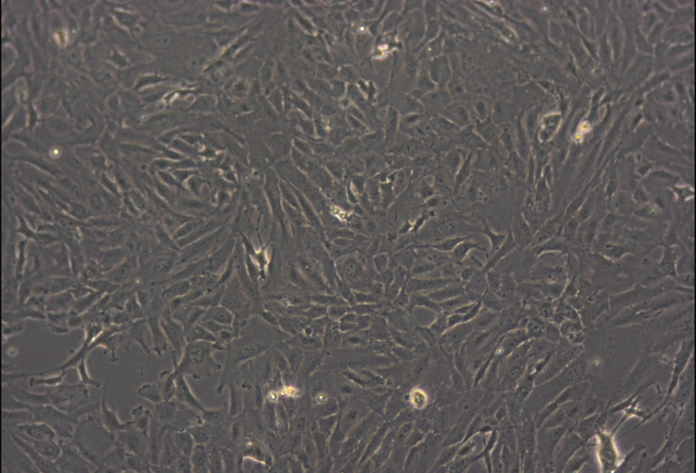 人软骨肉瘤细胞SW 1353 (STR鉴定正确)