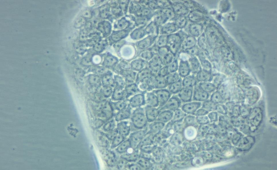   人胰腺癌细胞 Capan-2(STR鉴定正确)