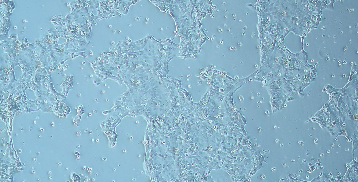  人食管腺癌 OE-33(STR鉴定正确)