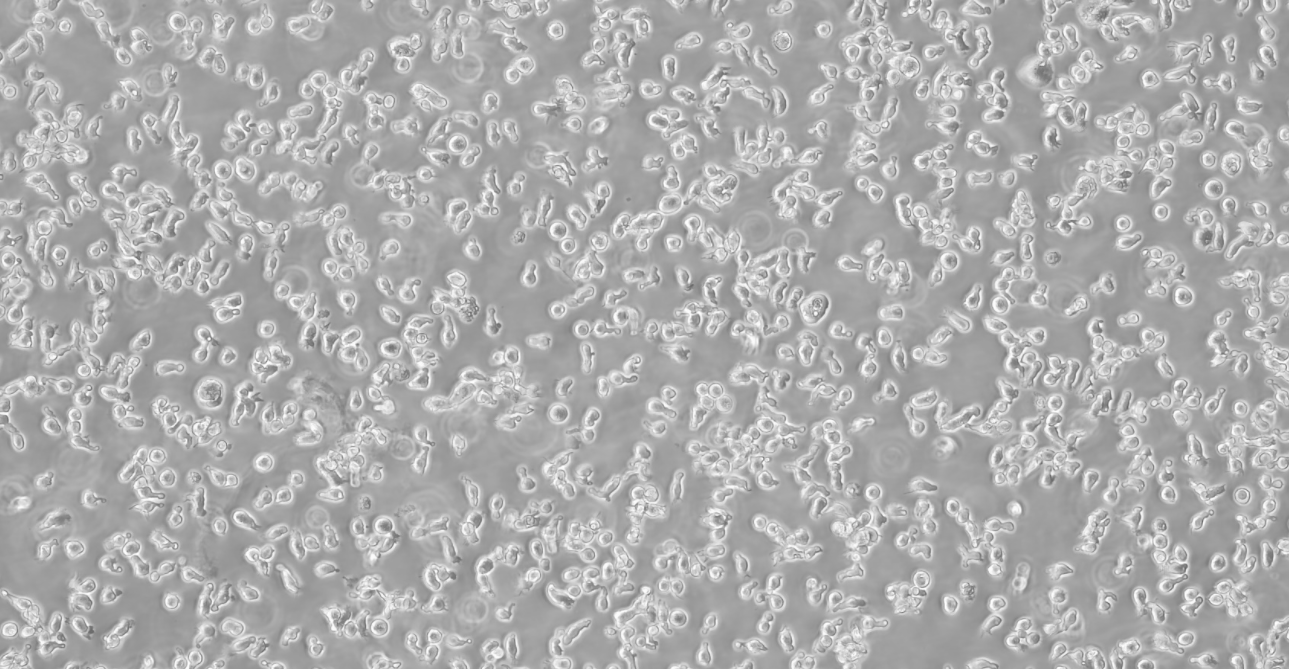 人淋巴母细胞T2(174×CEM.T2)(STR鉴定正确)