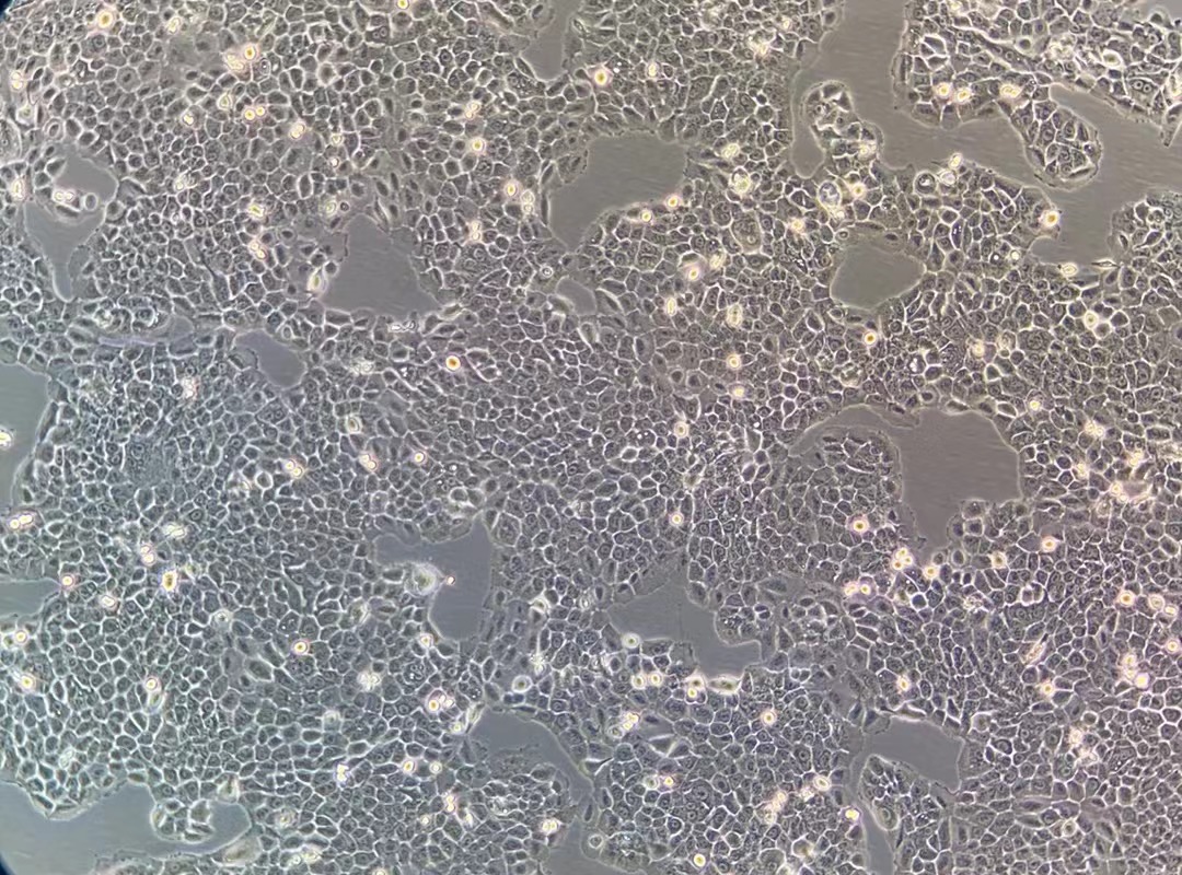 人肺腺癌细胞NCI-H292(STR鉴定正确)