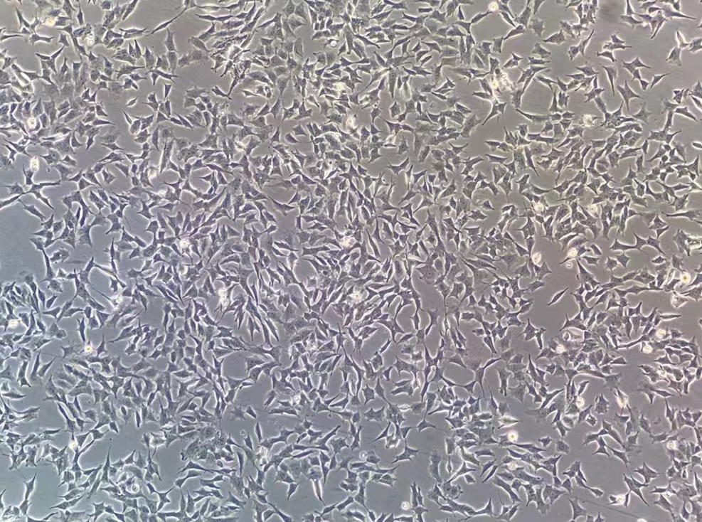 人神经母细胞瘤细胞SH-SY5Y(STR鉴定正确)