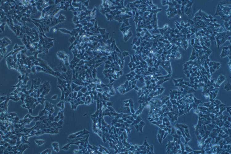 人肾上腺皮质腺癌细胞NCI-H295R(STR鉴定正确)