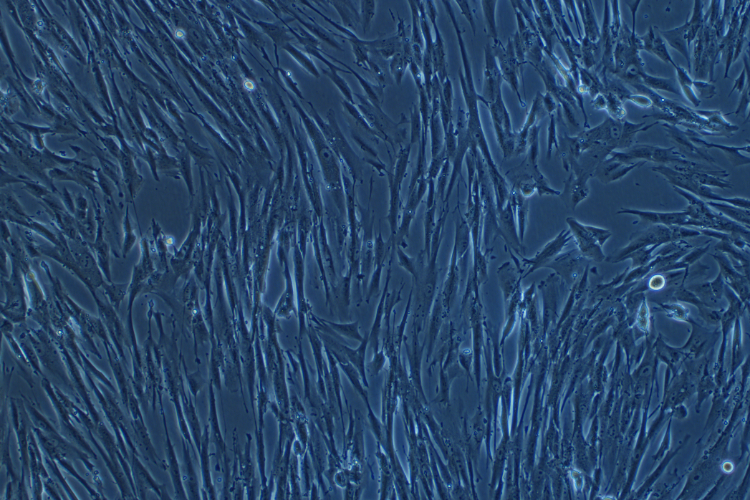  人胚肺细胞 MRC-5(STR鉴定正确)