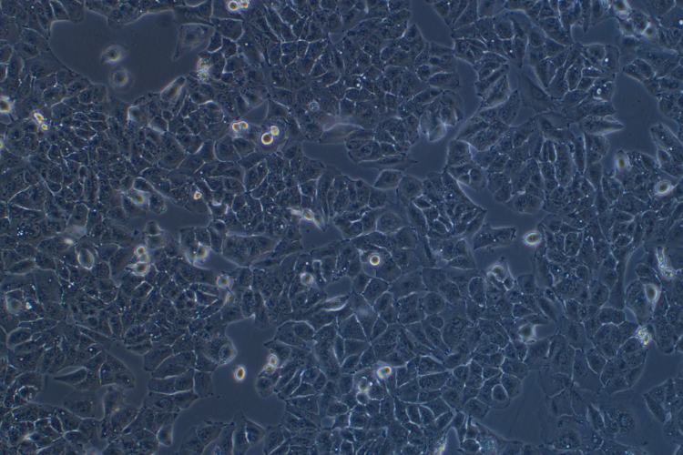 高转移人肝癌细胞MHCC97-H(STR鉴定正确)