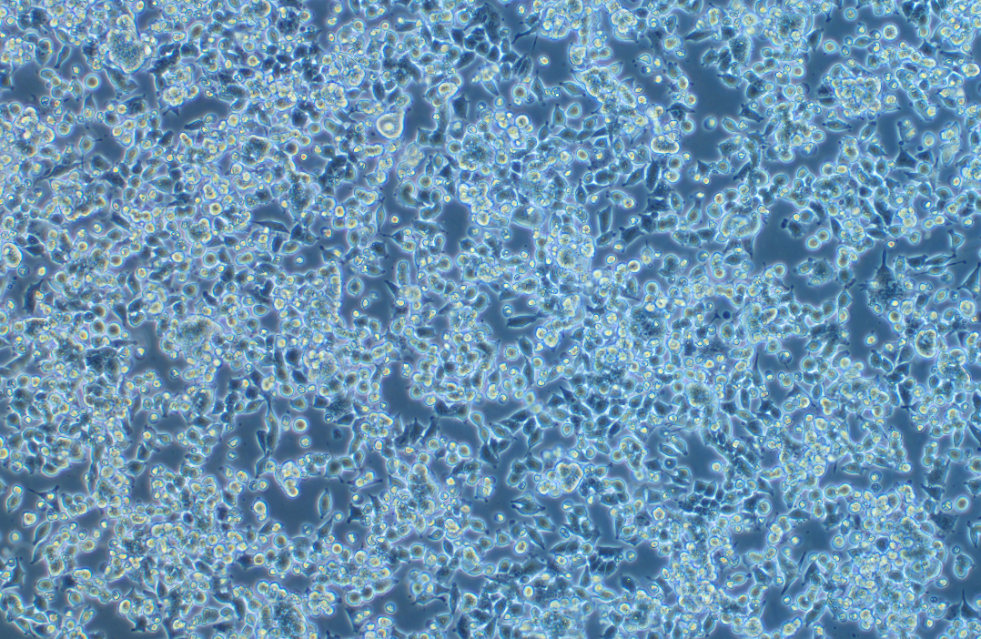 人肝癌细胞SNU-398(STR鉴定正确)