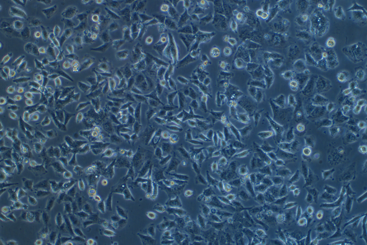 人喉癌细胞 LCC(STR鉴定正确)