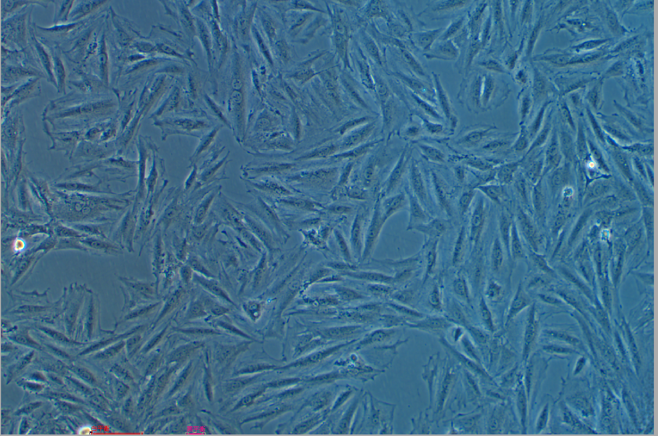 大鼠胚胎心肌细胞H9c2(2-1)+GFP